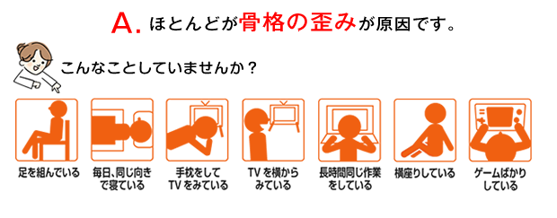 ほとんどは骨格の歪みが原因です・